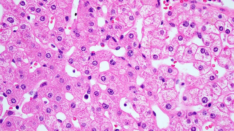 Image-based carcinogen detection